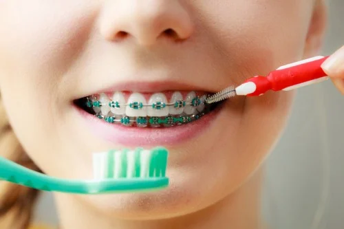 girl cleaning braces