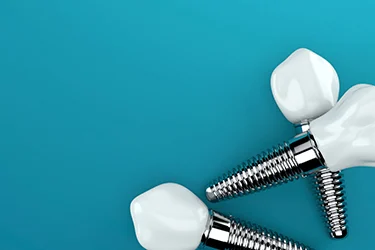 dental implants