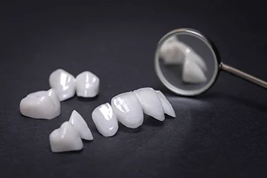 dental veneers on table