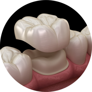 Tooth crown