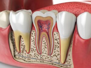 root canal therapy for tooth pain with a Phoenix dentist - The Norterra Dentist