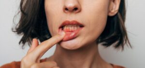 young woman pulling down her lip exposing her inflamed gums, possible sign of early periodontal disease